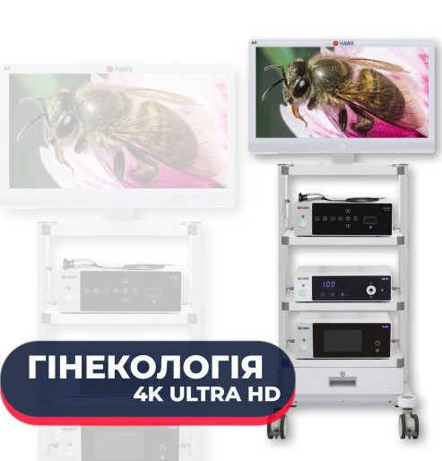 Гінекологічна ендоскопічна стійка 4K Ultra HD